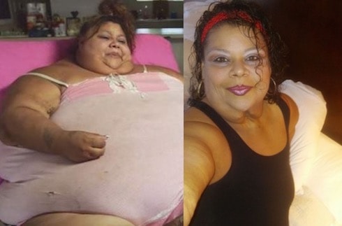 My 600 Lb Life biggest weight loss Lupe