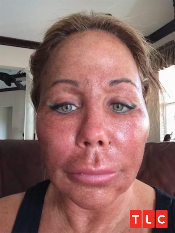 TLC sMothered Mary plastic surgery photo