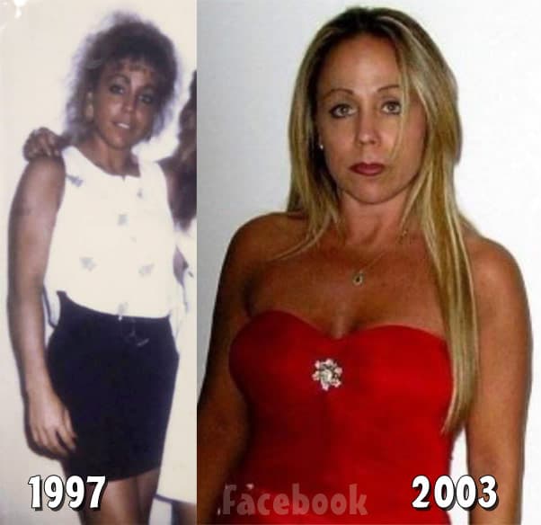 TLC sMothered Mary throwback photos before plastic surgery?