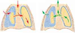 1899_89_132-open-pneumothorax