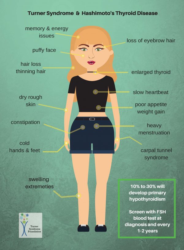 Thyroid Disease With Turner Syndrome Turner Syndrome Foundation