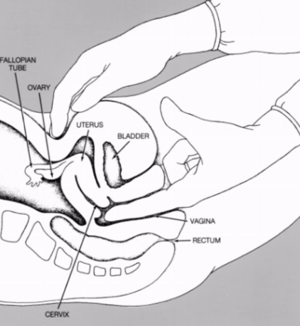 Cpt Code 76856 76857 And 76830 Pelvic Ultrasound Coding