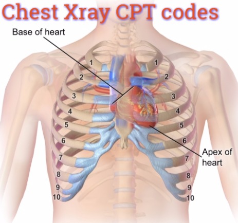 X Ray Chest Cpt Code Coding Guide For Coders Medical Coding Guide
