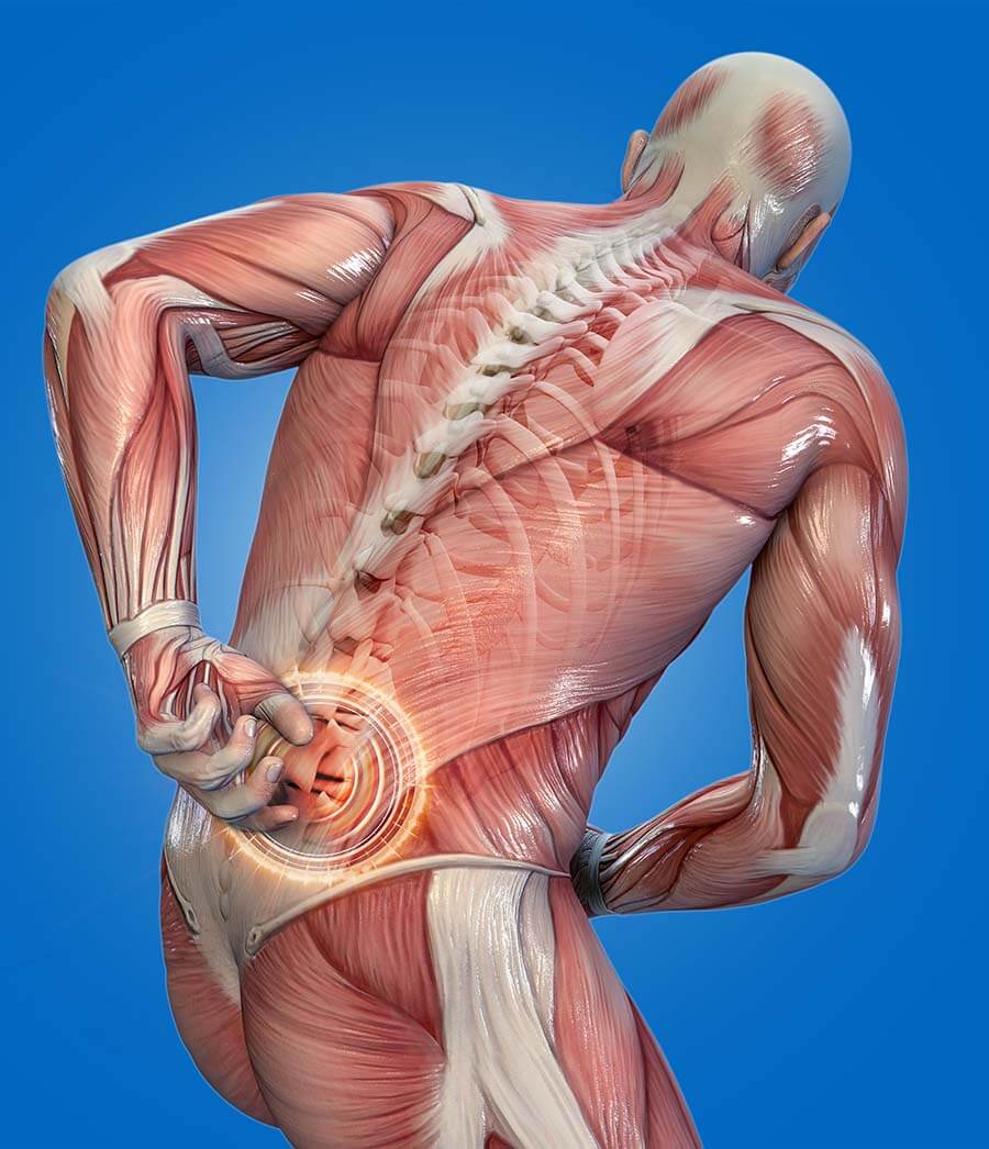 Severe Lower Back Pain 5 Of The Most Common Causes