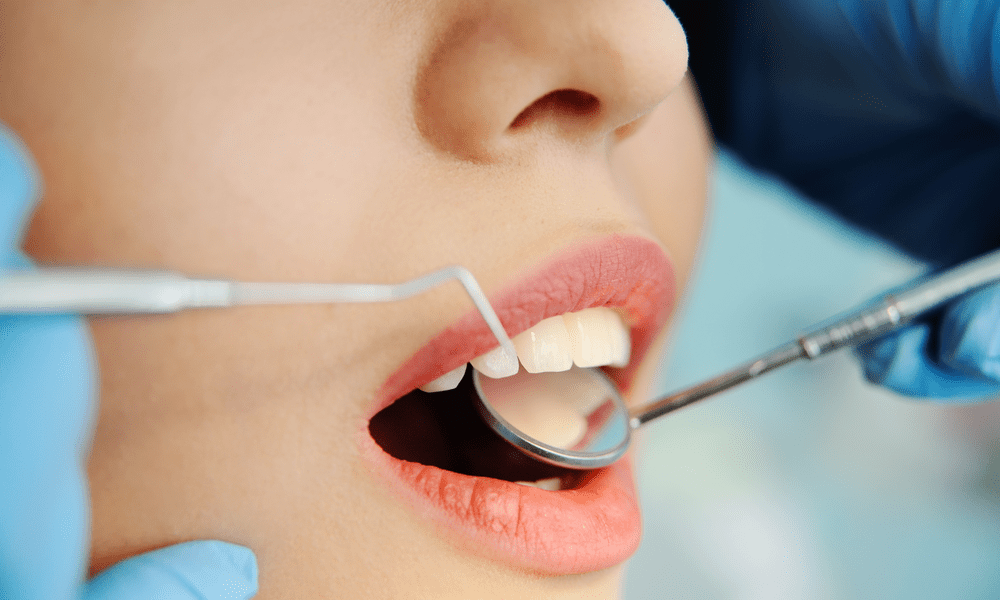 Gengive Gonfie Rimedi Naturali Contro La Gengivite Centri Dentistici Primo