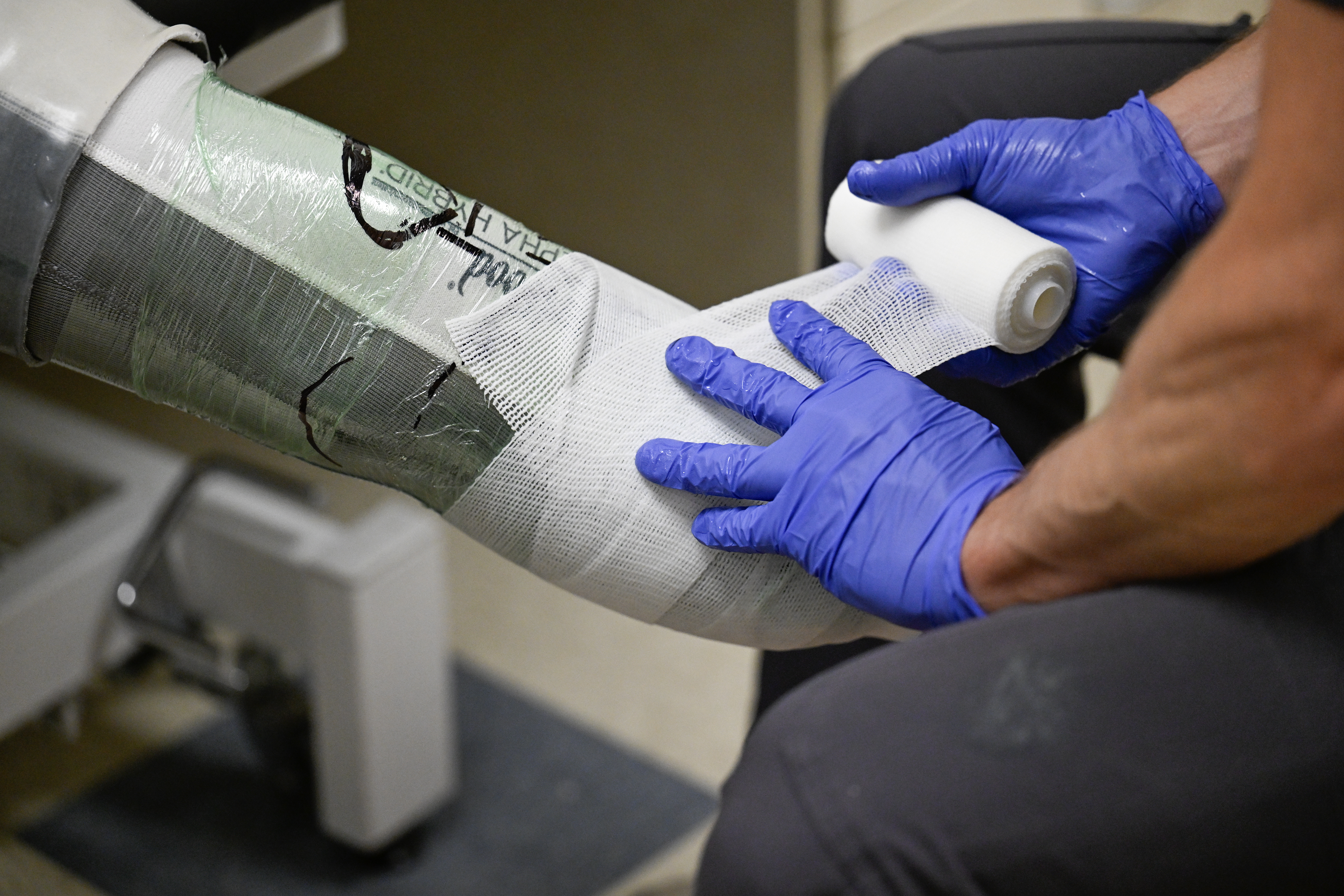 From right: Dan Milius, certified prosthetist, creates a mold of Marty Adams amputation to begin the process of fitting a prosthetic during an appointment in the outpatient pavilion at University of Colorado Anschutz Medical Campus in Aurora. (Matthew Jonas/Staff Photographer)