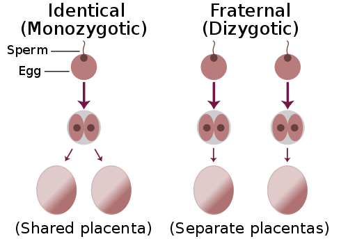 Key Difference Between Monozygotic and Dizygotic Twins