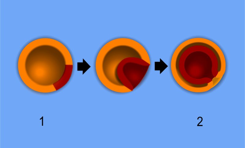 Key Difference - Diploblastic vs Triploblastic1