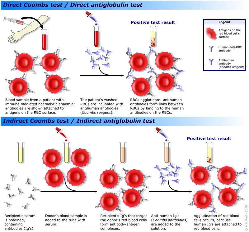 Difference Between Direct and Indirect Coombs Test