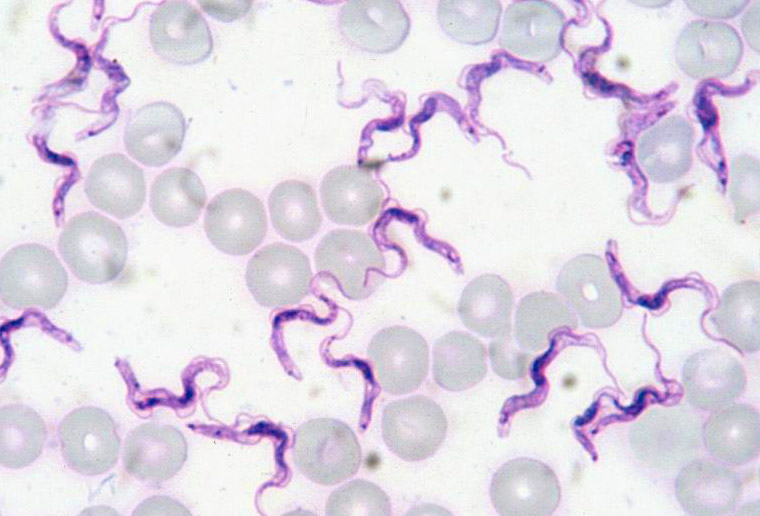 Difference Between Giemsa Stain and Wright Stain 