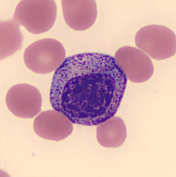 Key Difference Between Promyelocyte and Myelocyte