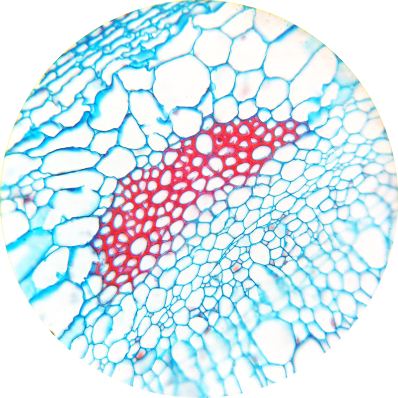 Difference Between Fibres and Sclereids 