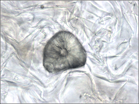 Key Difference Between Fibres and Sclereids