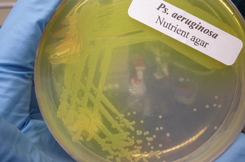 Difference Between Pseudomonas Aeruginosa and Enterobacteriaceae