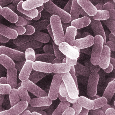 Difference Between Lactobacillus and Bifidobacterium