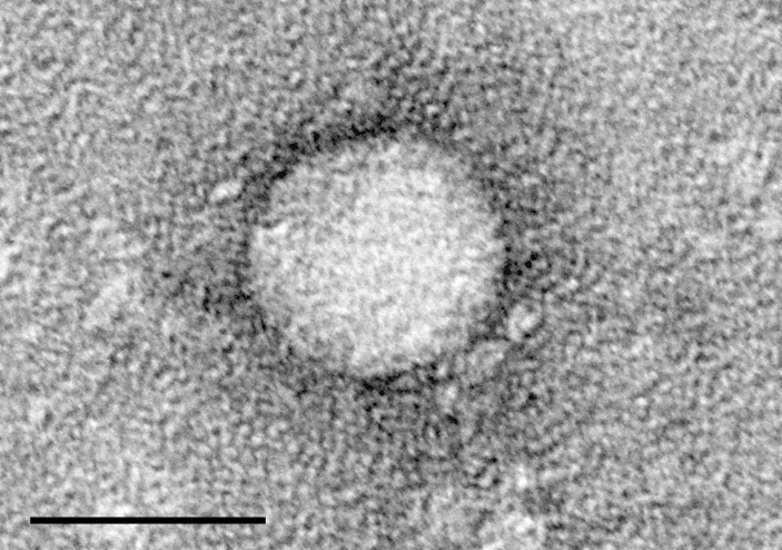 Difference Between Positive and Negative Sense RNA Virus