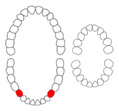 Difference Between First and Second Premolar