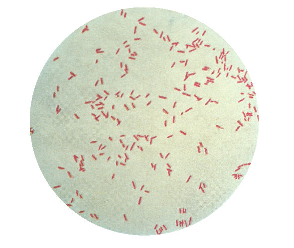 Difference Between Pseudomonas aeruginosa and Pseudomonas fluorescens