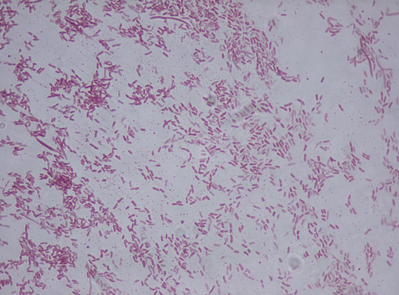 Key Difference Between Pseudomonas aeruginosa and Pseudomonas fluorescens