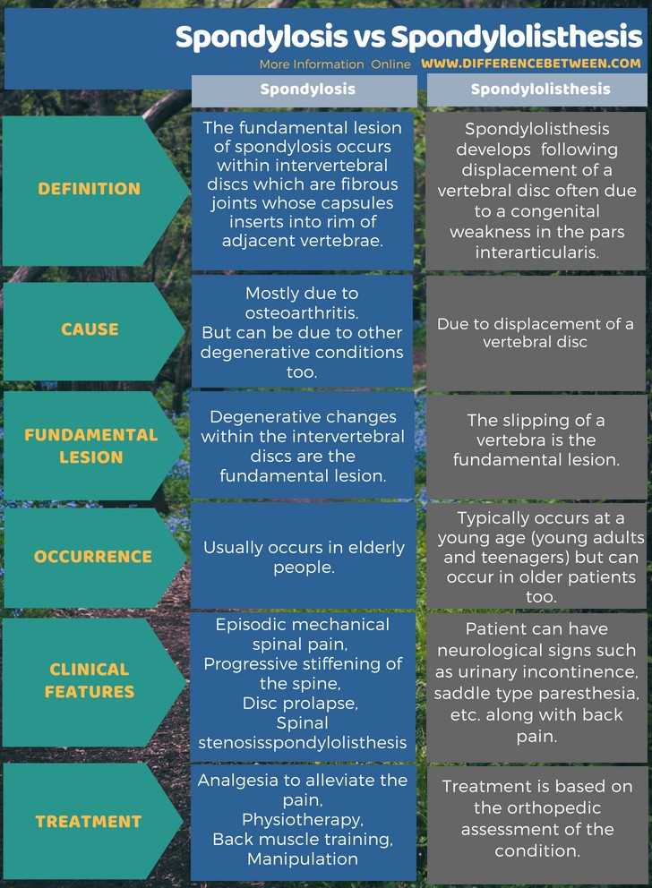 Difference Between Spondylosis and Spondylolisthesis in Tabular Form