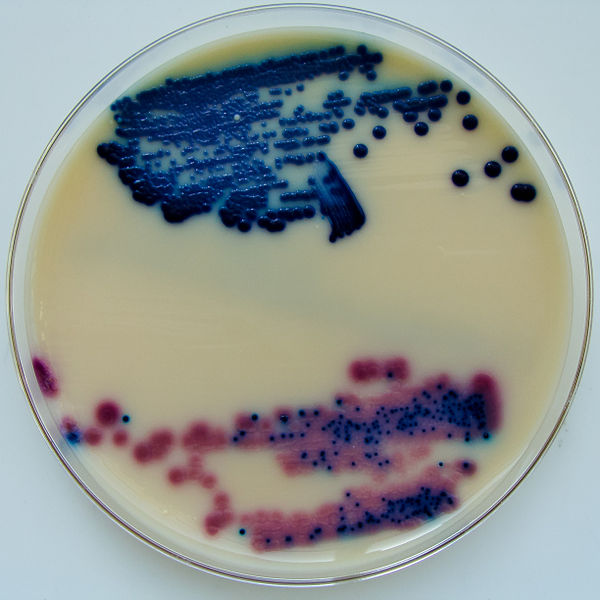 Key Difference Between Urinalysis and Urine Culture