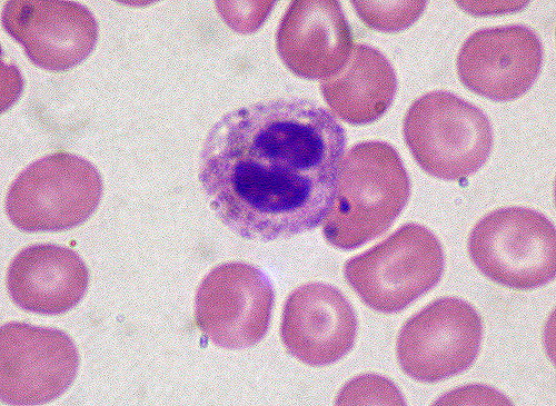 Difference Between Microphage and Macrophage