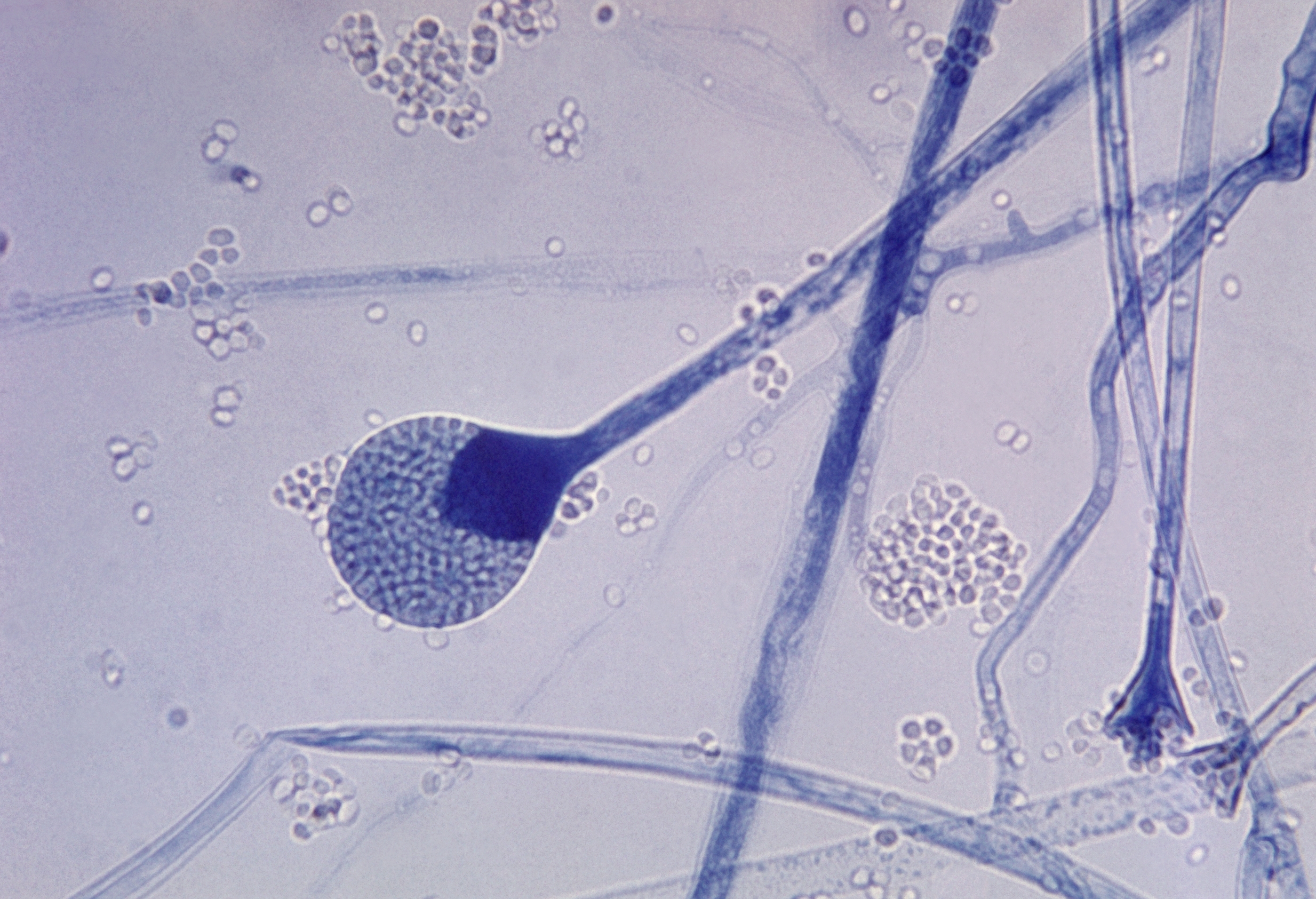 Difference Between Mucor and Rhizopus