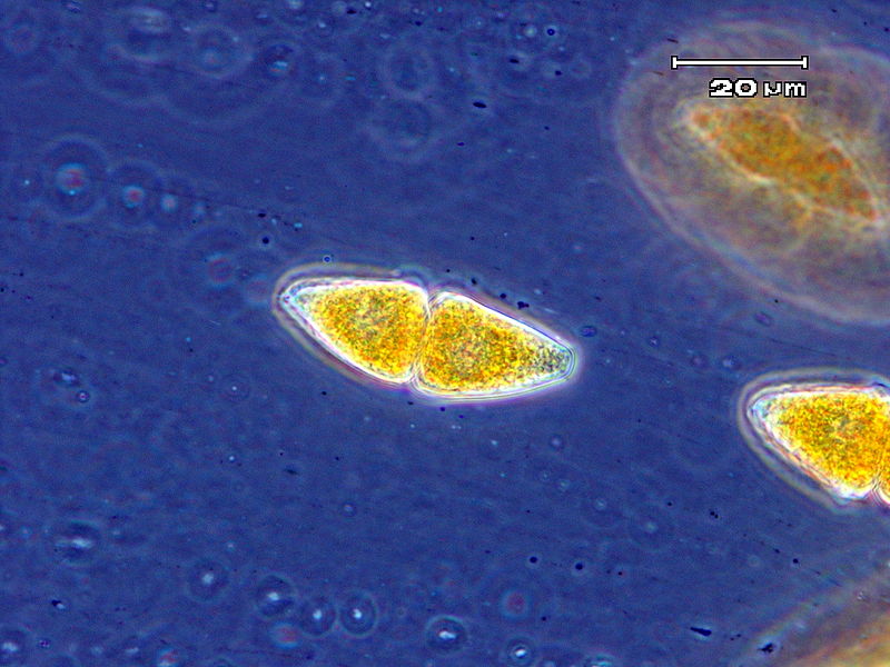 Key Difference - Uredospore vs Teliospore