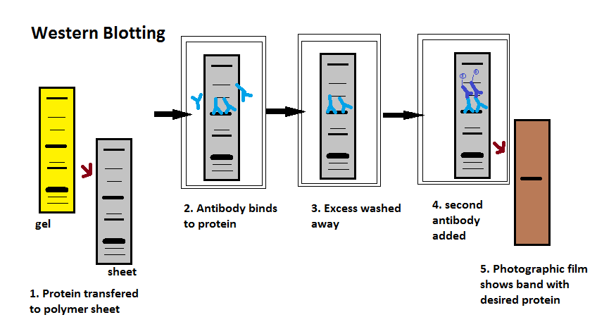 Difference Between Elisa and Western Blot