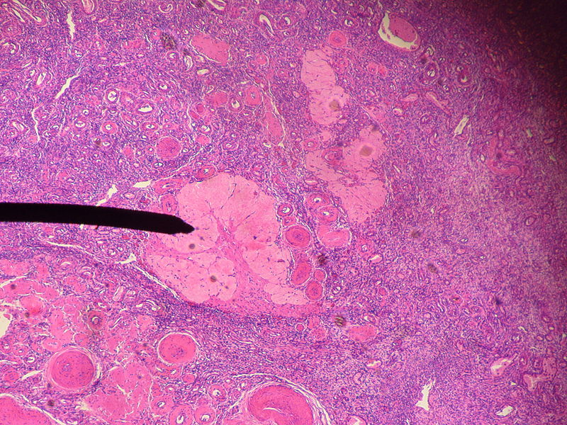 Key Difference - Corpus Luteum vs Corpus Albicans