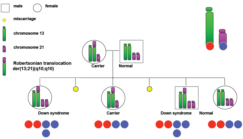 Difference Between Robertsonian Translocation and Isochromosome