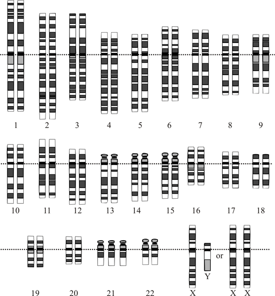 Difference Between Monogenic Disorders and Chromosomal Disorders