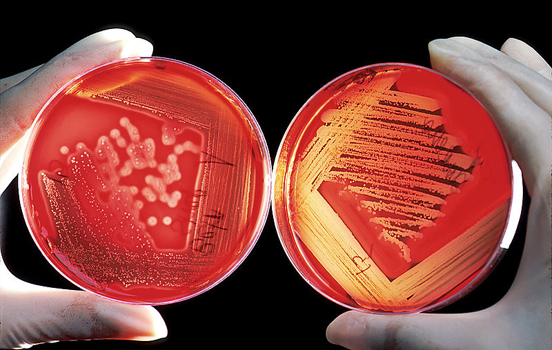 Difference Between Agar and Alginate