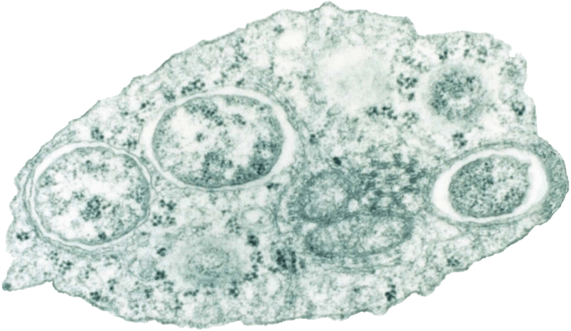 Key Difference - Alpha vs Beta vs Gamma Proteobacteria