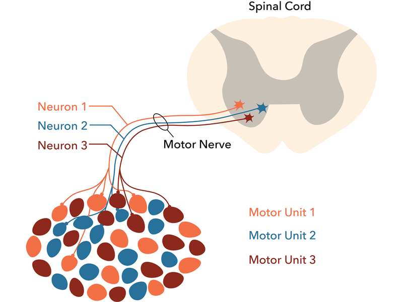 Difference Between Innervated and Denervated Muscles