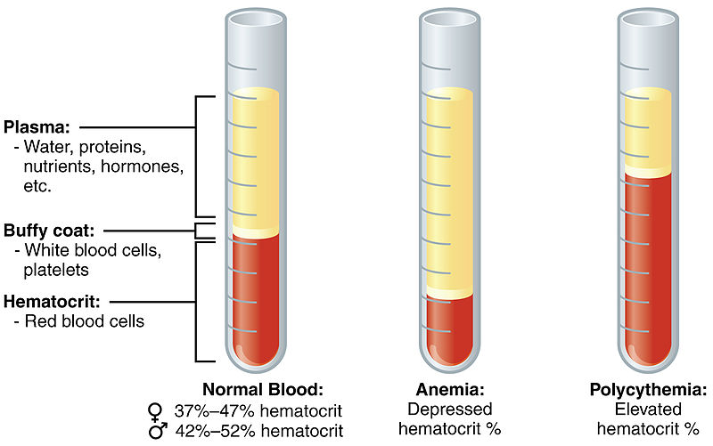 Primary Polycythemia and Secondary Polycythemia - Side by Side Comparison 