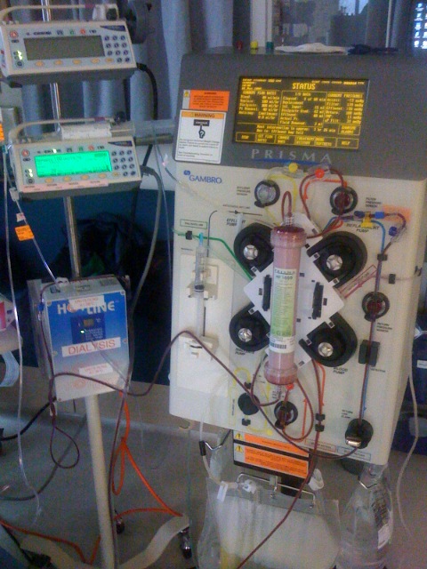 Dialysis and CRRT - Side by Side Comparison 