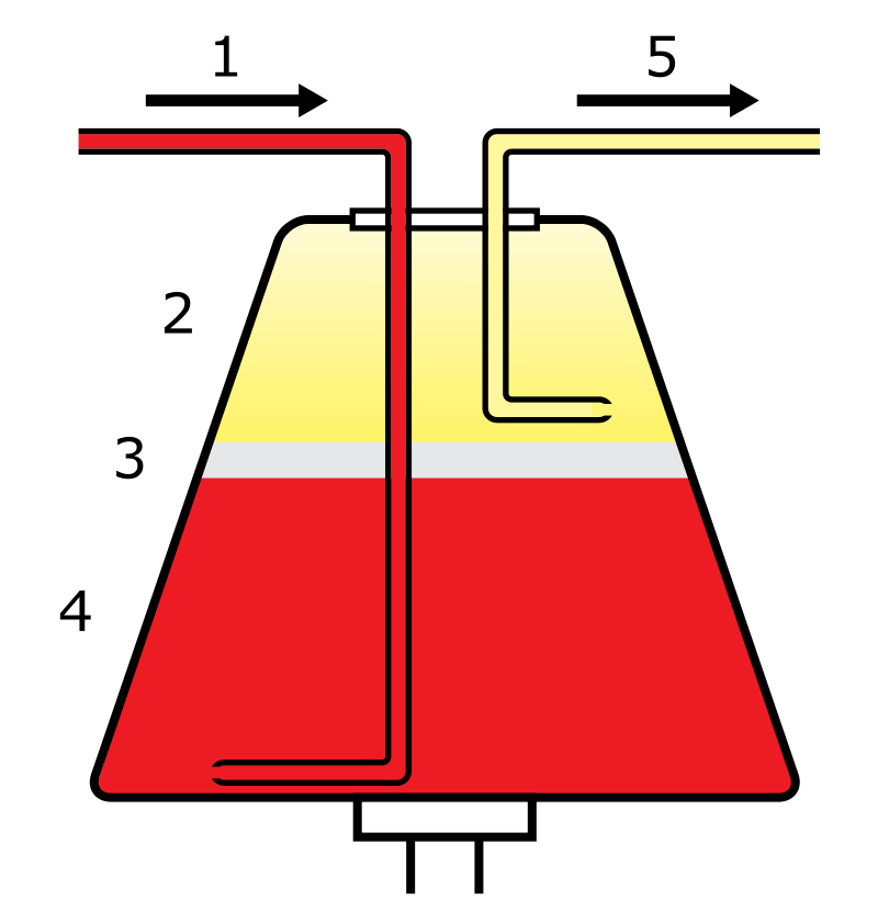 Apheresis vs Dialysis in Tabular Form