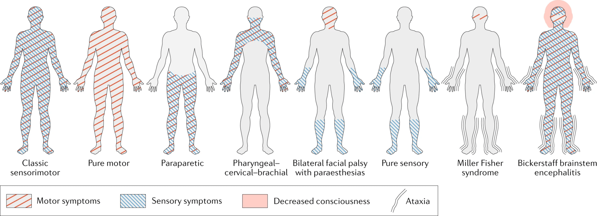 Guillain Barre Syndrome vs Myasthenia Gravis in Tabular Form