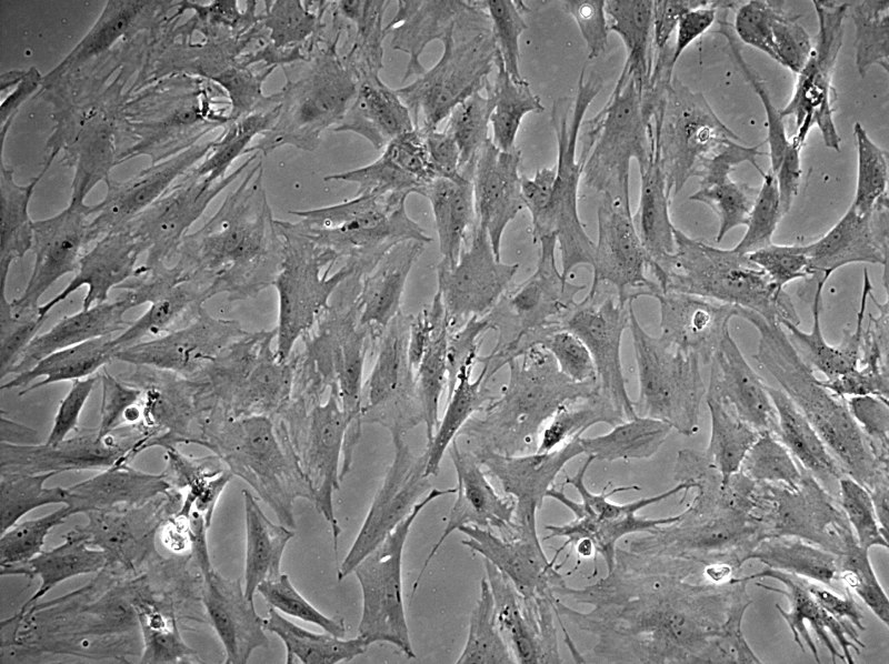 Fibroblast and Myofibroblast - Side by Side Comparison 