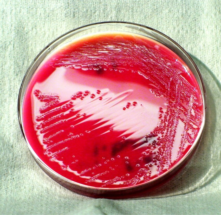 Salmonella vs Shigella in Tabular Form