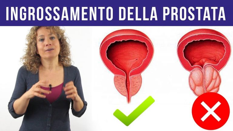 Ipertrofia Prostatica Benigna E I Disturbi Della Vescica Come Otosection