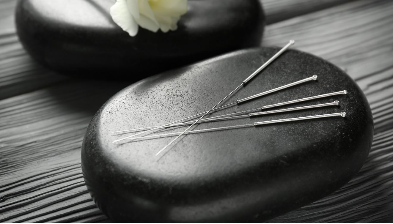 Acupuncture 2 Acupuncture. Bend Oregon