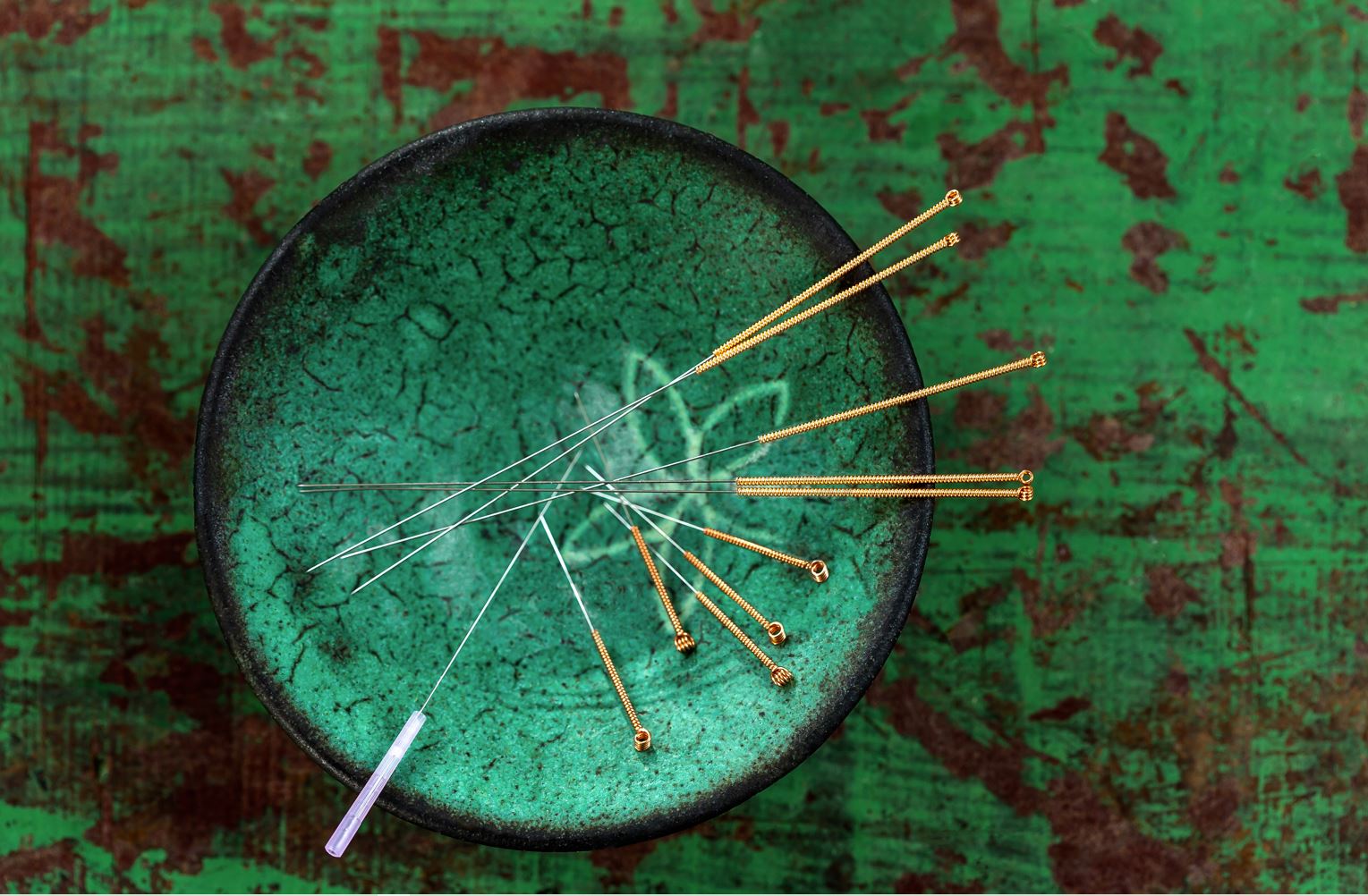 Acupuncture Community Style Acupuncture