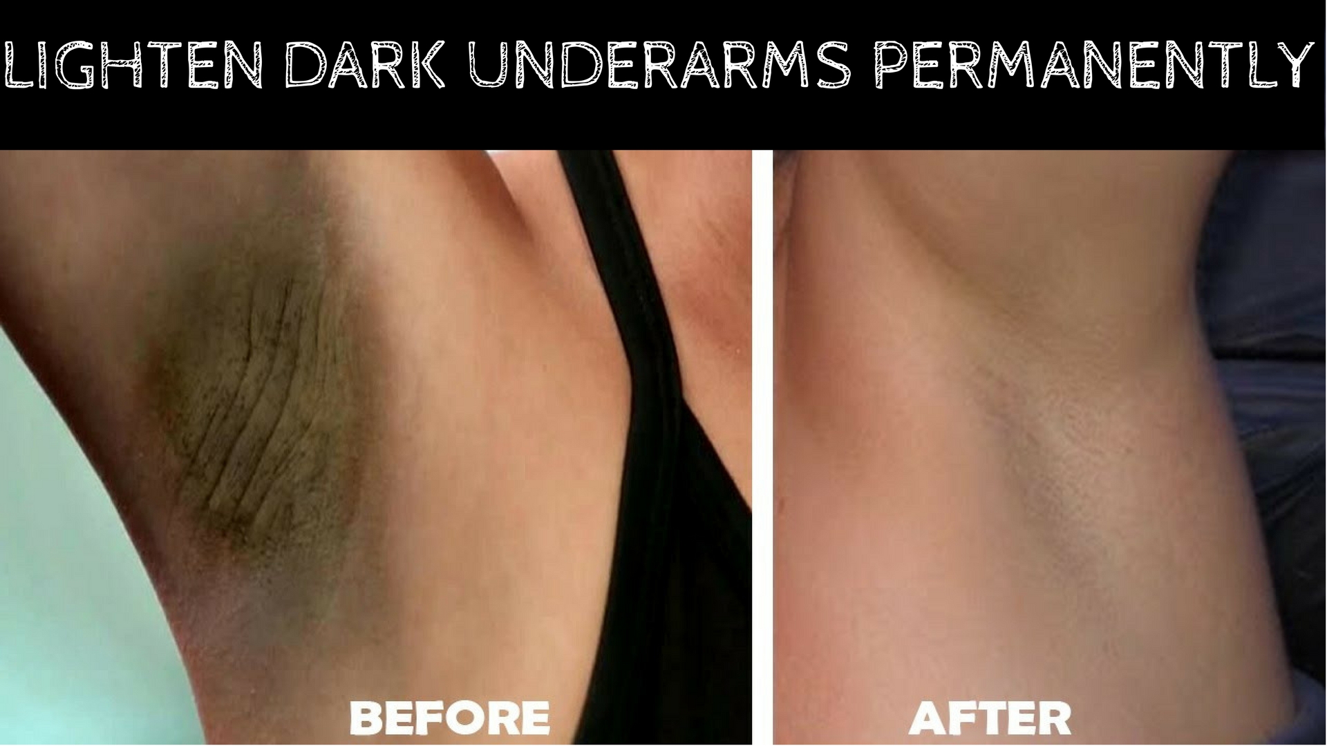 How To Lighten Dark Underarm Naturally And Fast Permanent Results