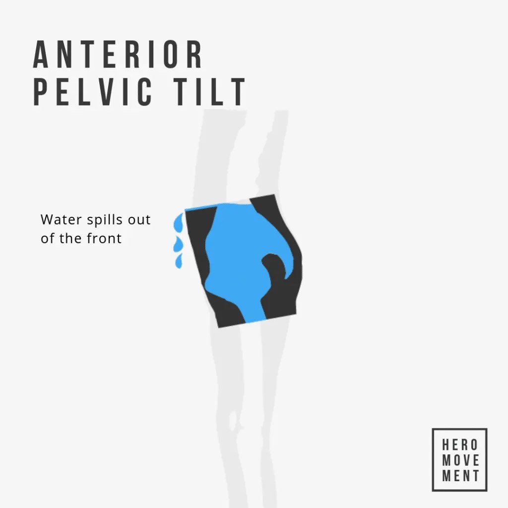 How To Fix Posterior Pelvic Tilt Guide Routine Hero Movement
