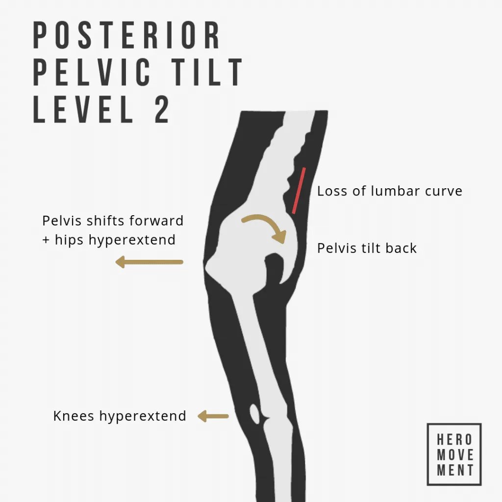 How To Fix Posterior Pelvic Tilt Guide Routine Hero Movement