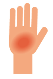 Aerial Yoga And Friction Burns What They Are How To Avoid Them And Treat Them Loops World