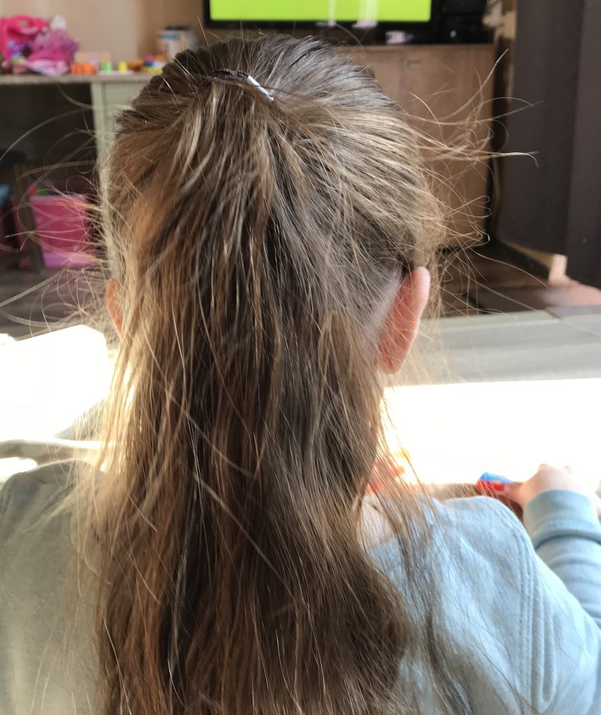 Tips Om Statisch Haar Te Verminderen Living The Special Needs Life