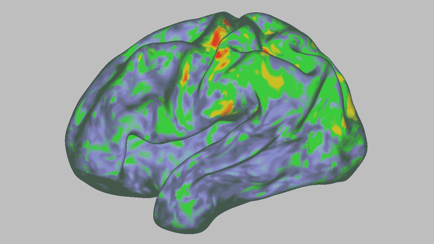 brain scan psilocybin